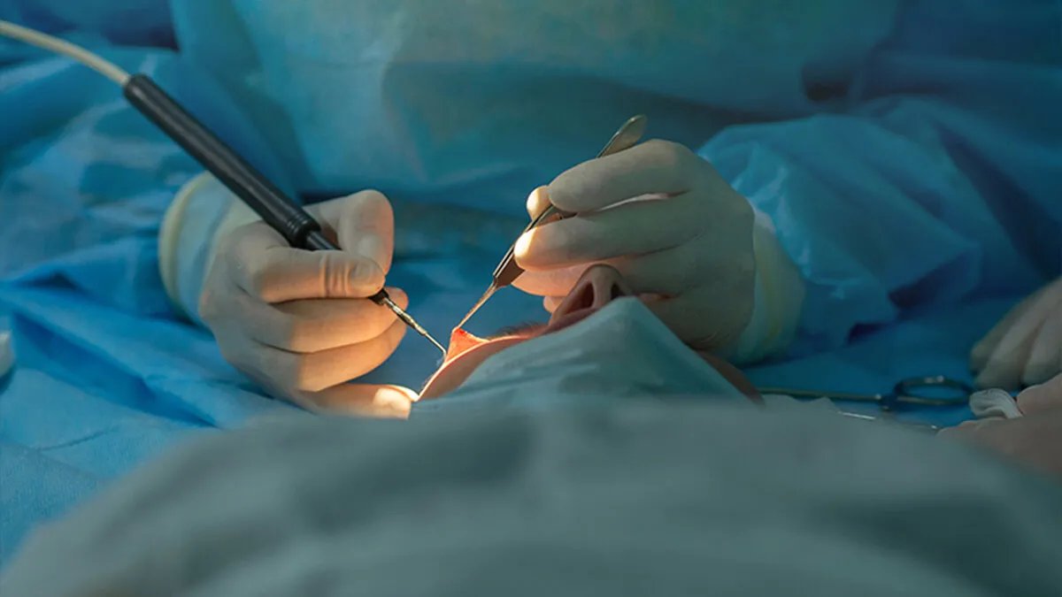 حملة مجانية لإنقاذ البصر: آلاف العمليات الجراحية لإزالة المياه البيضاء في سوريا