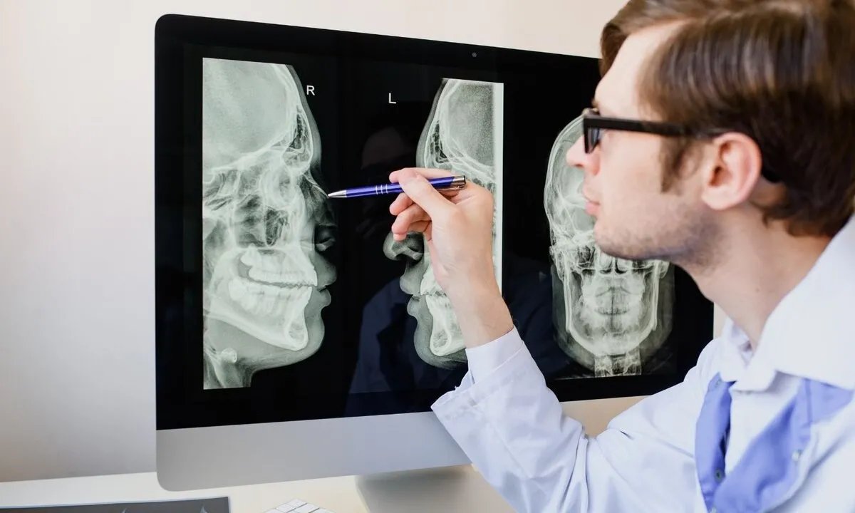 كسور قاعدة الجمجمة: الأسباب، الأعراض، التشخيص، وطرق العلاج