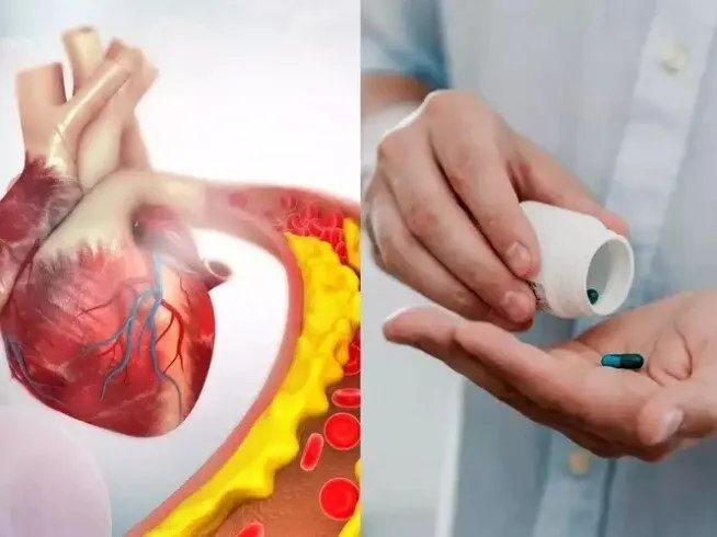 دراسة واعدة: دواء جديد للكوليسترول يقلل خطر النوبات القلبية والسكتات الدماغية