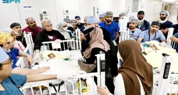 نجاح سعودي مبهر: فصل توأم إريتيري ملتصق بالرأس في عملية معقدة بالرياض