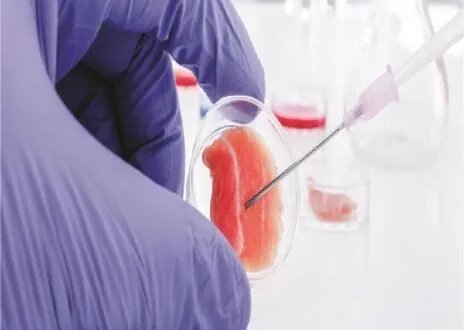 ثورة في علاج العقم: الخلايا الجذعية تعيد الأمل وتفتح آفاقًا جديدة للإنجاب