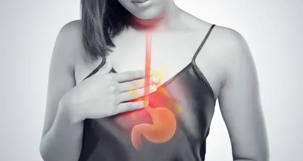 تجنبها لراحة معدتك: قائمة بالأطعمة التي تزيد من حموضة المعدة