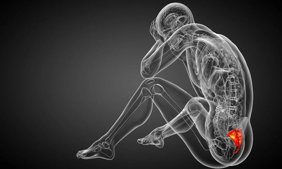 كسر العُصعص: الأسباب، الأعراض، التشخيص، وطرق العلاج المختلفة