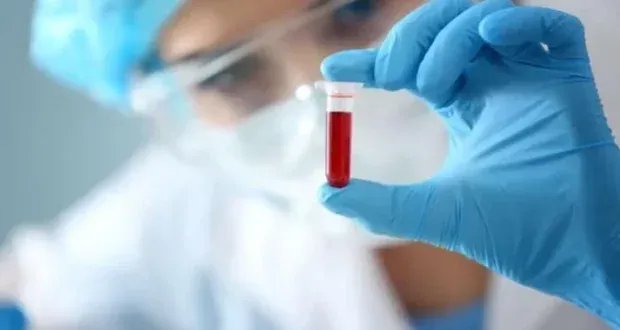 اكتشاف فصيلة دم جديدة وفريدة من نوعها في العالم تحمل اسم "غوادا سالب"