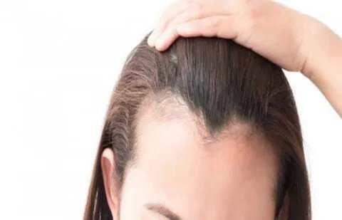 وداعاً لزراعة الشعر: حلول مبتكرة لاستعادة كثافة الشعر بتقنيتي الريجينيرا والبلازما