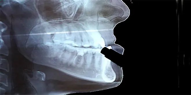 إنجاز علمي ياباني: فريق بحثي ينجح في تطوير عضيات عظم الفك من الخلايا الجذعية