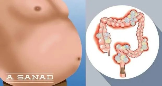 غازات البطن: أسبابها، أعراضها، وطرق العلاج الفعالة
