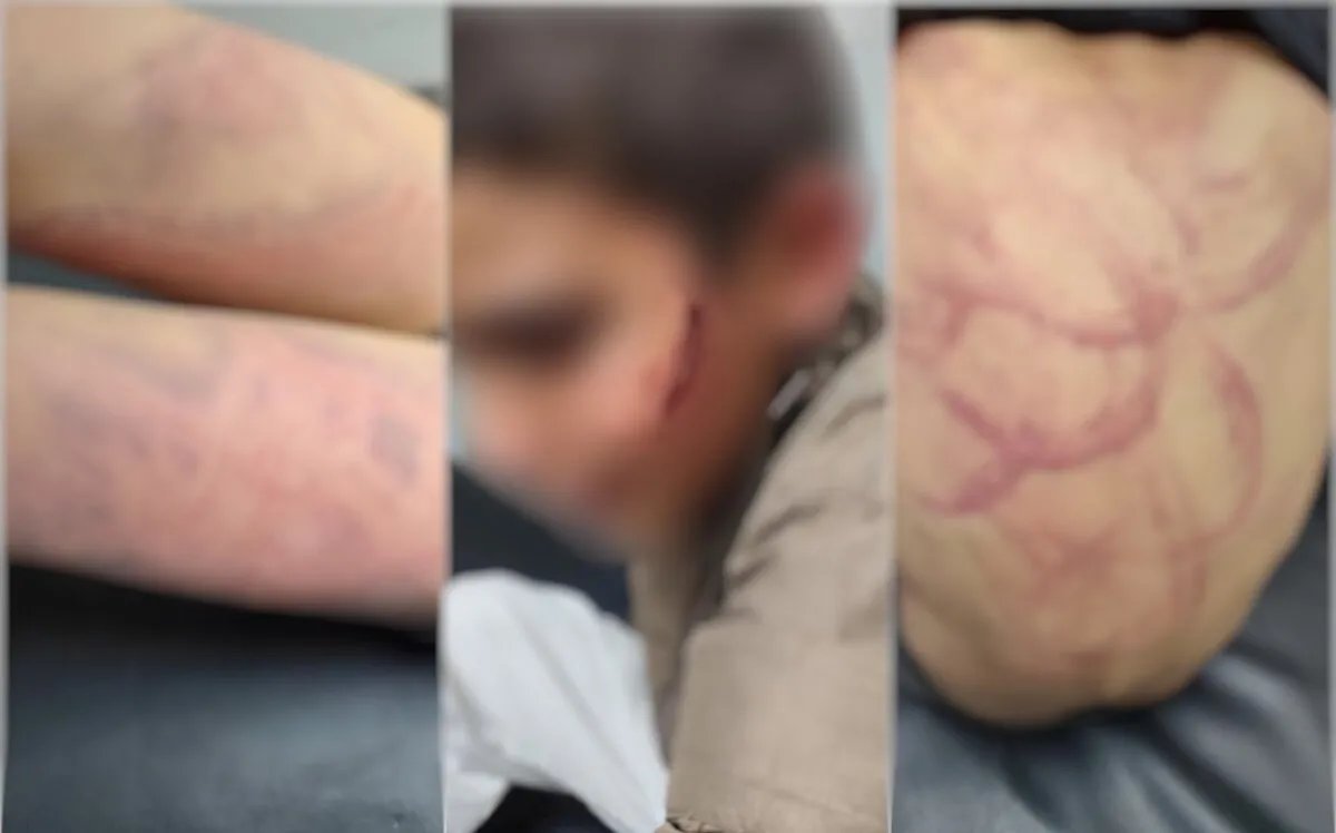 إدلب: أب يعذب طفله بوحشية بسبب كسر موقد غاز.. إصابات خطيرة تهدد مستقبله!