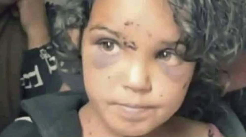 السويداء: ميليشيا الهجري ترتكب جريمة مروعة بحق طفلة وتقتل شقيقها أمام عينيها