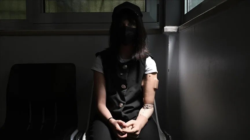 قصة أمل: ندى السورية تستعيد حياتها بذراع صناعية في تركيا