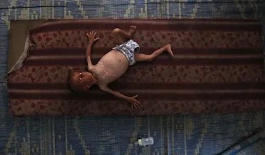 تفاقم الأزمة الإنسانية في غزة: المجاعة تشتد في ظل تعثر المفاوضات