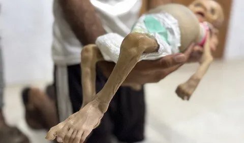 تحذير من كارثة إنسانية: غزة على شفا مقتلة جماعية تهدد حياة 100 ألف طفل بسبب نقص حليب الأطفال