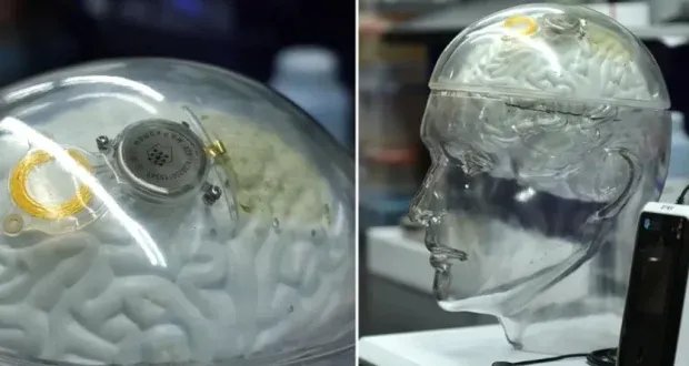 سباق تكنولوجيا الدماغ: الصين تتحدى "نيورالينك" بشريحة "بيناو-1"