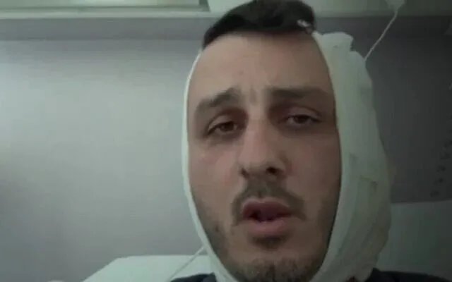 شجار في اليونان: سوري يعتدي على إسرائيلي ويقضم أذنه على خلفية خلاف حول فلسطين