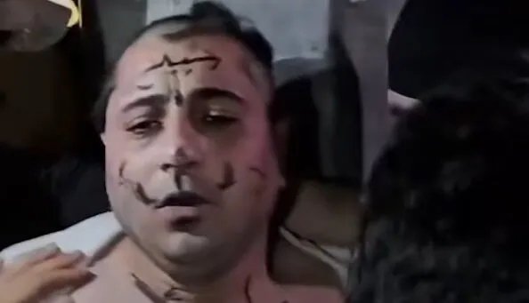 حلب: اعتداء على مطرب شعبي بالضرب والإهانة بسبب مواقف مؤيدة للنظام السابق (فيديو)