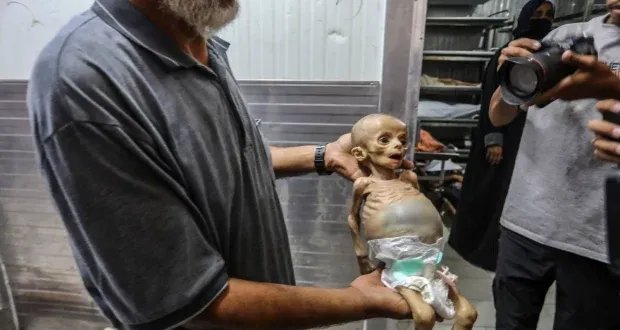 يونيسف: 28 طفلاً يقتلون يومياً في غزة بسبب القصف الإسرائيلي والتجويع