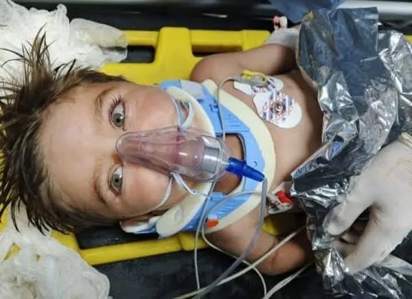 الرقة: إنقاذ الطفل علي عبدي بأعجوبة بعد سقوطه في بئر عميقة استمر 15 ساعة