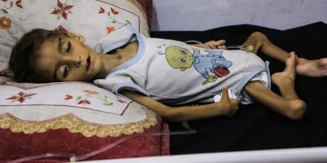 لازاريني يحذر: العالم لا يجب أن يصمت أمام موت الأطفال جوعاً في غزة