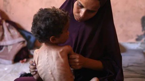 نتنياهو ينكر المجاعة في غزة ويزعم: صور الأطفال الضعفاء 'مفبركة' وأسبابها 'أمراض جينية'