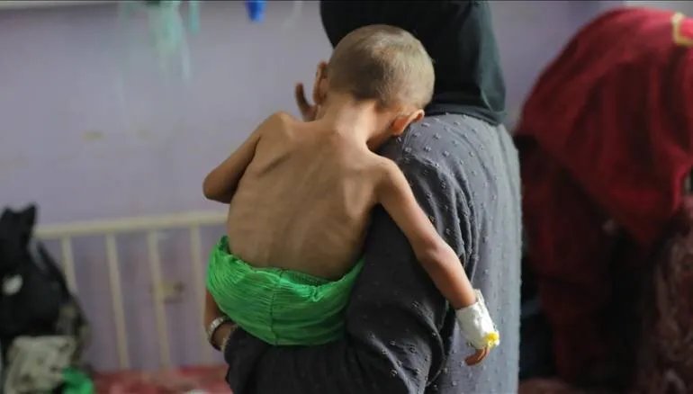 ارتفاع مأساوي: 271 شهيدًا في غزة بسبب التجويع الإسرائيلي، بينهم 112 طفلاً