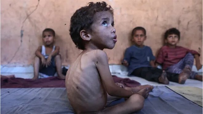 ارتفاع مأساوي: 11 وفاة جديدة بسبب المجاعة في غزة، والأمم المتحدة تحذر من تفاقم الوضع