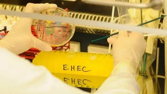 تفشي بكتيريا خطيرة في ألمانيا: تسجيل إصابات ودعوات لتشكيل فريق إدارة أزمات