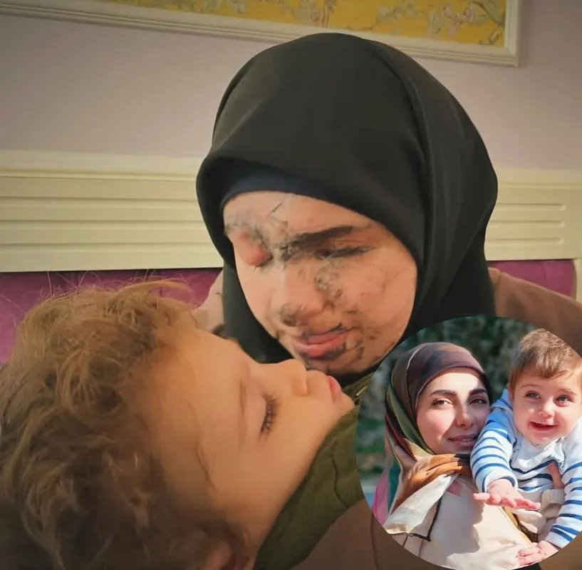 في الذكرى الأولى لتفجير البيجر: قصص مؤثرة لجرحى يروونها للمرة الأولى