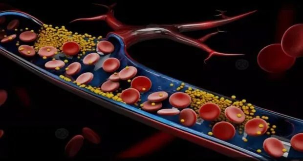 خطر صامت يهدد الجميع: ارتفاع الكوليسترول وأثره على صحة القلب وكيفية الوقاية