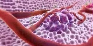 ما أسباب السرطان وكيف يمكن الوقاية منه؟ الدكتور وليد شوقي يوضح