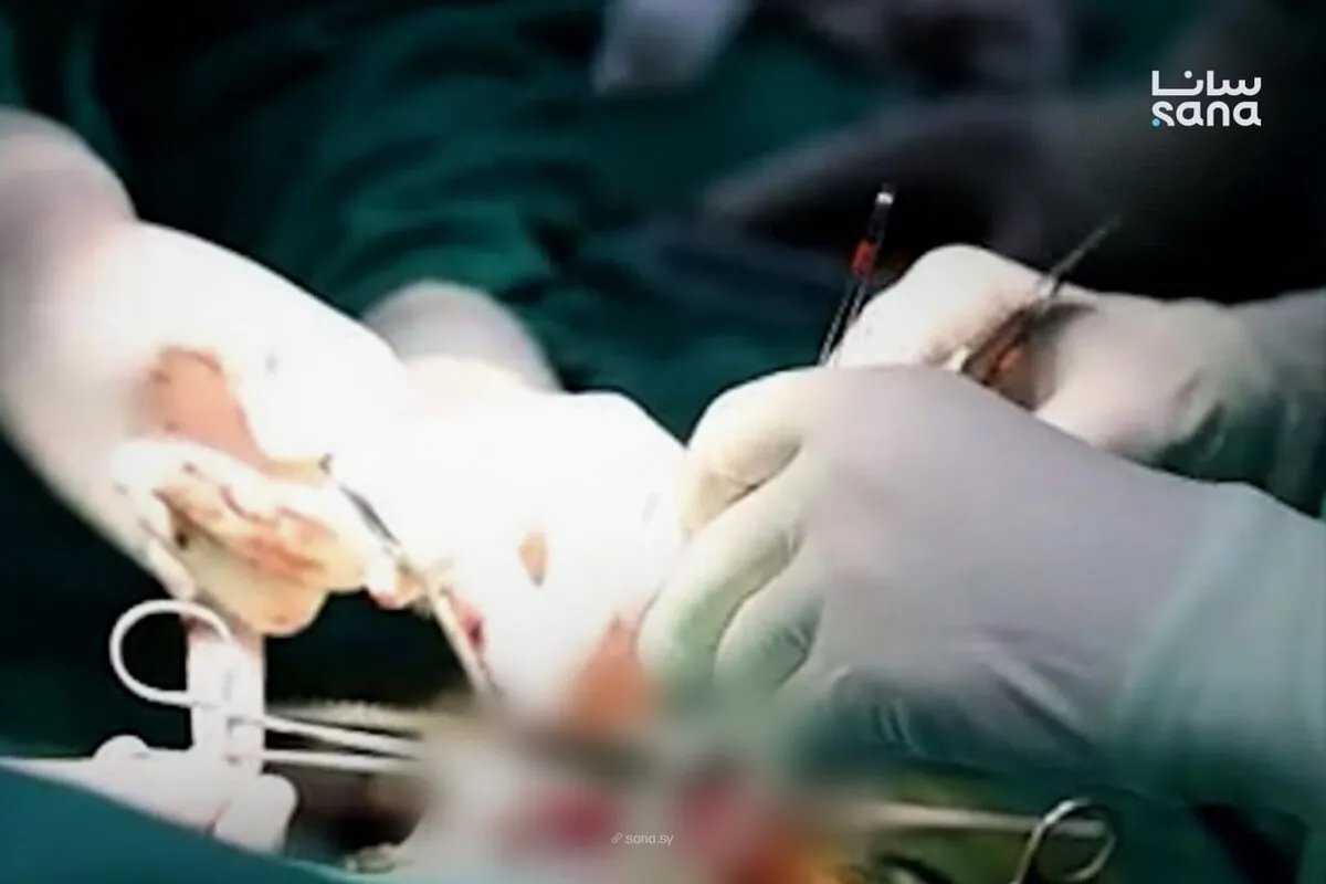 إنجاز طبي في دمشق: تقنية مبتكرة لعلاج تشوهات القلب الولادية باستخدام أنسجة المريض