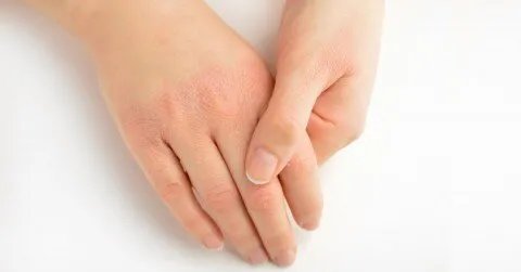 وداعاً لجفاف اليدين قبل الزفاف: نصائح ذهبية للعناية ببشرتك في الخريف