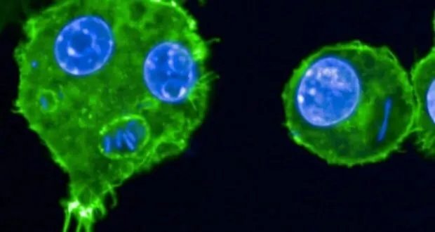 تحذير عالمي: تفشي البكتيريا المقاومة للمضادات الحيوية ينذر بعواقب وخيمة