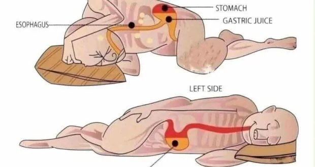 النوم على الشق الأيمن: نظرة علمية وفوائد صحية