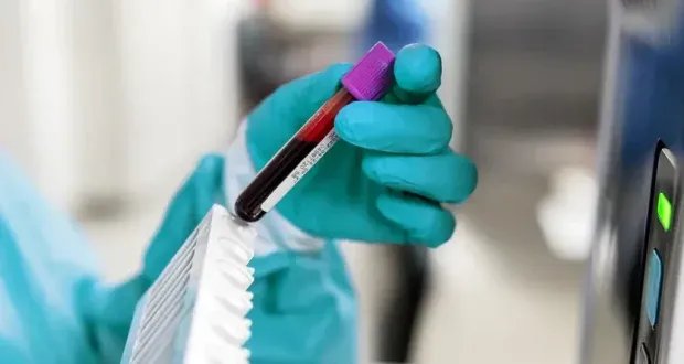 طفرة في الكشف المبكر عن السرطان: فحص دم جديد يرصد 50 نوعاً