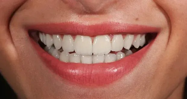 ثورة في طب الأسنان التجميلي: الذكاء الاصطناعي يعيد تشكيل الابتسامة