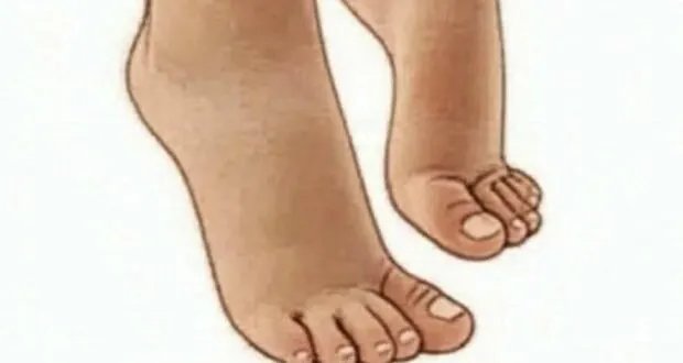اكتشف الفوائد الصحية المذهلة للمشي على رؤوس الأصابع: تقوية العضلات وحرق الدهون وتحسين القوام