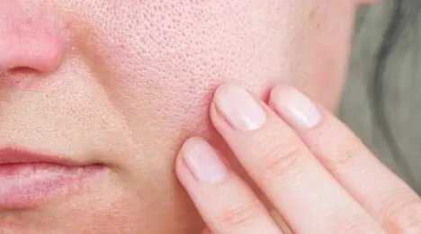 وداعاً للمسام الواسعة: دليلكِ لبشرة مشدودة ونضرة كالحرير