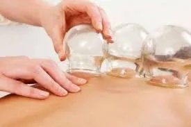 الحجامة في نوفمبر 2025: الأوقات المثالية، الأدعية المستحبة، ونصائح لتعزيز الشفاء