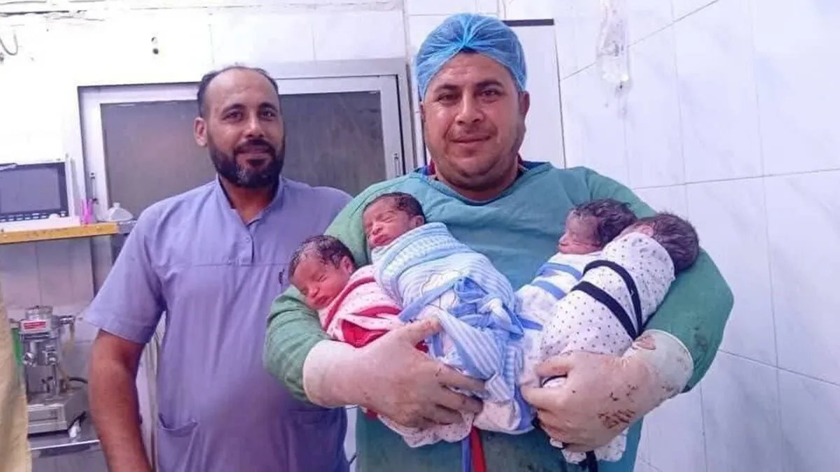 حدث نادر: ولادة توأم رباعي في مشفى الميادين بدير الزور