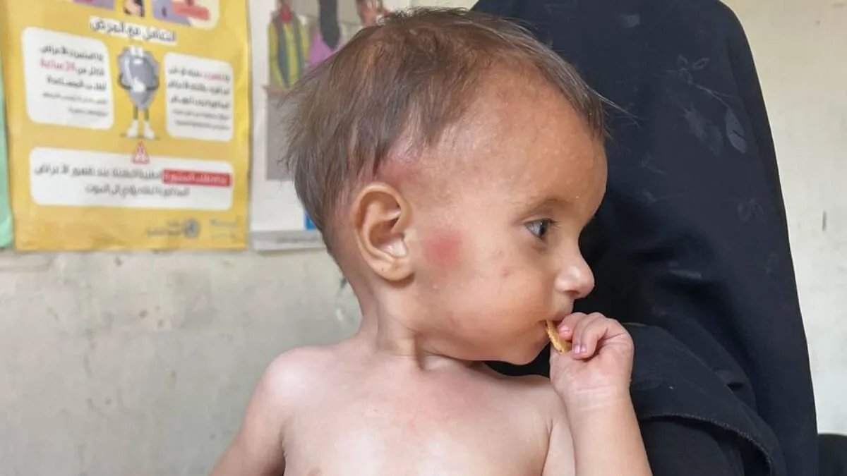 تدهور التمويل يهدد القطاع الصحي السوري بالانهيار: تفاصيل مقلقة تكشفها الأمم المتحدة